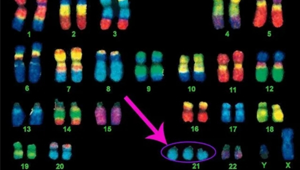 Image_20260911-aneuploidy
